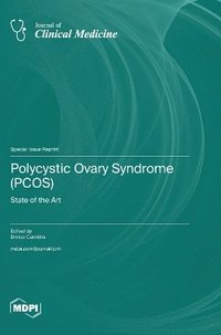 bokomslag Polycystic Ovary Syndrome (PCOS): State of the Art