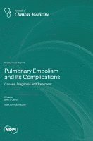 Pulmonary Embolism and Its Complications: Causes, Diagnosis and Treatment 1