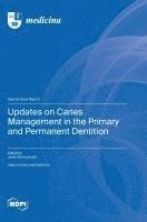 Updates on Caries Management in the Primary and Permanent Dentition 1