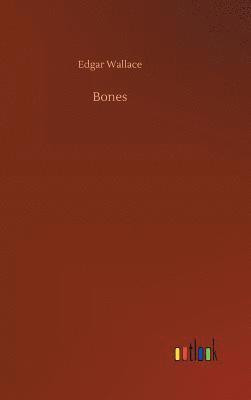 Bones