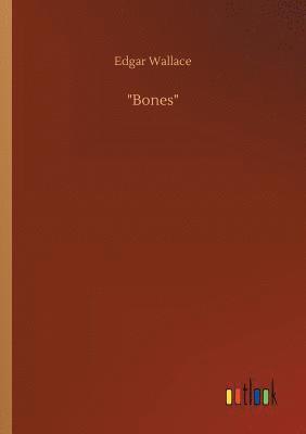 Bones