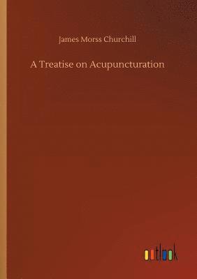 bokomslag A Treatise on Acupuncturation