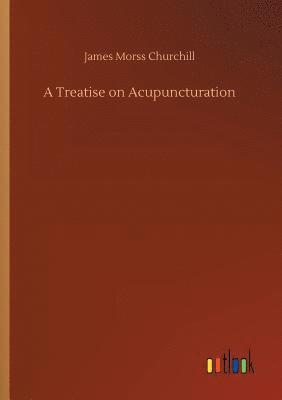 James Morss Churchill - Treatise on Acupuncturation, Häftad