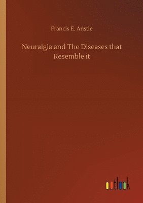 Neuralgia and The Diseases that Resemble it