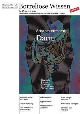 Ute Fischer, Bernhard Siegmund - Borreliose Wissen aktuell, Häftad