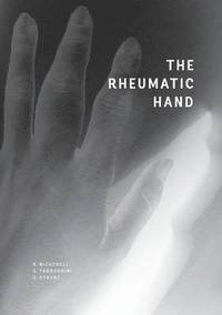 bokomslag The Rheumatic Hand