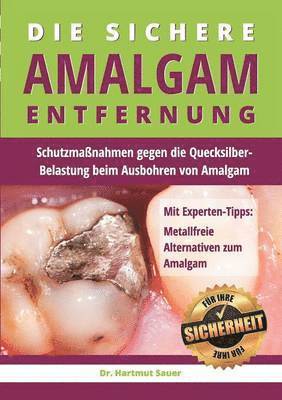 Die sichere Amalgam-Entfernung 1