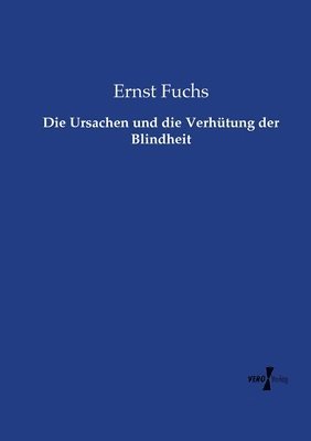 bokomslag Die Ursachen und die Verhutung der Blindheit