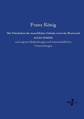 Franz König - Tuberkulose der menschlichen Gelenke sowie der Brustwand und des Schädels, Häftad