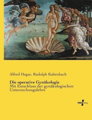 operative Gynäkologie 1