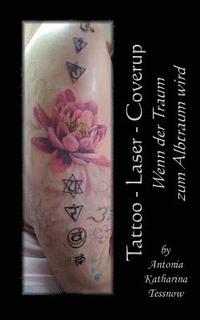 bokomslag Tattoo - Laser - Cover Up
