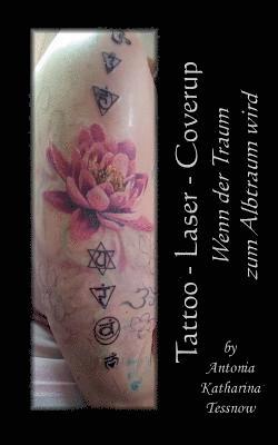 Tattoo - Laser - Cover Up 1