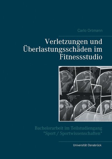 bokomslag Verletzungen und Überlastungsschäden im Fitnessstudio