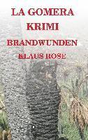 bokomslag Brandwunden