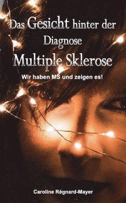 Gesicht hinter der Diagnose Multiple Sklerose