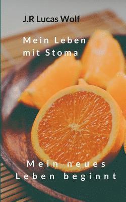 Mein Leben mit Stoma
