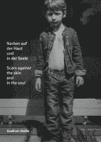 Narben auf der Haut und in der Seele