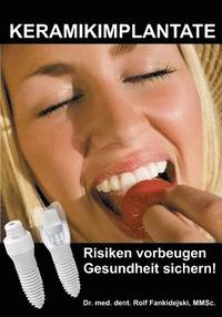 bokomslag Keramikimplantate