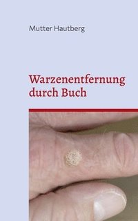 bokomslag Warzenentfernung durch Buch