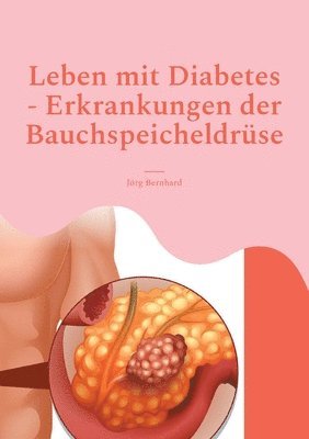 bokomslag Leben mit Diabetes - Erkrankungen der Bauchspeicheldrse