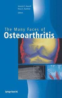 bokomslag The Many Faces of Osteoarthritis