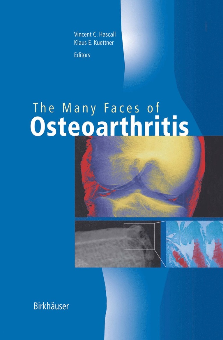 Vincent C. Hascall, Klaus E. Kuettner - Many Faces of Osteoarthritis, Inbunden