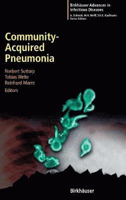 Community-Acquired Pneumonia 1