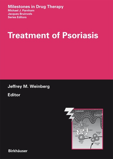 Jeffrey M. Weinberg - Treatment of Psoriasis, Inbunden