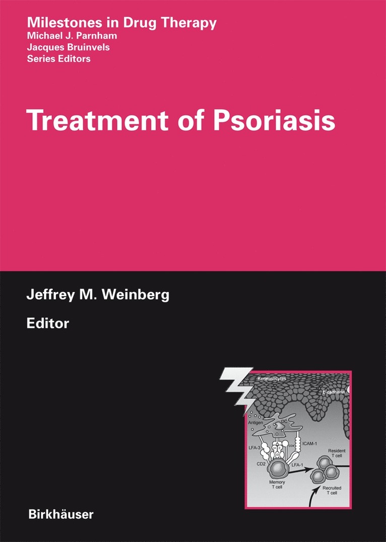 Treatment of Psoriasis 1