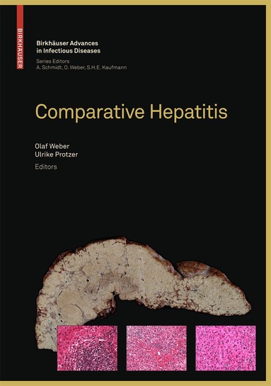 Olaf Weber, Ulrike Protzer - Comparative Hepatitis, Inbunden