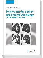 bokomslag Infektionen der oberen und unteren Atemwege