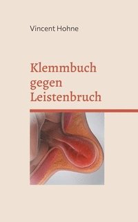 bokomslag Klemmbuch gegen Leistenbruch