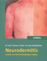 bokomslag Neurodermitis