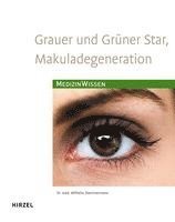 Wilhelm Stemmermann - Grauer  und Grüner Star, Makuladegeneration, Häftad