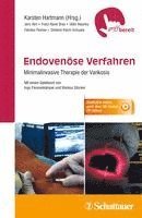 bokomslag Endovenöse Verfahren