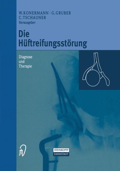 Werner Konermann, Gerd Gruber, Christian Tschauner - Die Hüftreifungsstörung, Inbunden