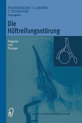 Die Hftreifungsstrung 1