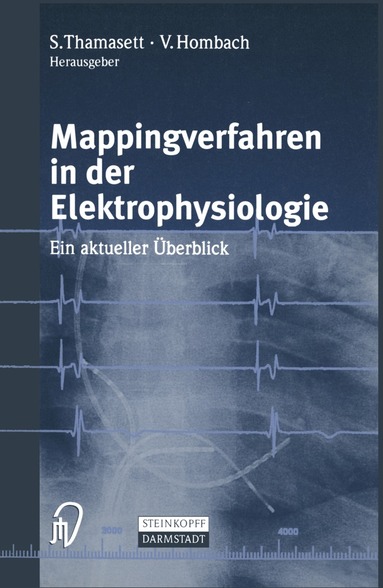 S. Thamasett, Vinzenz Hombach - Mappingverfahren in der Elektrophysiologie, Häftad