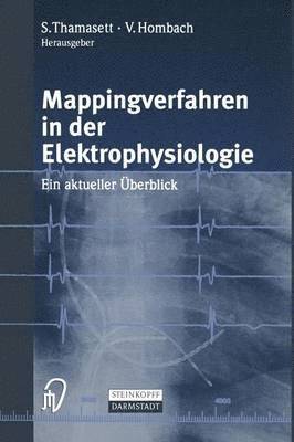 Mappingverfahren in der Elektrophysiologie 1