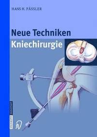 bokomslag Neue Techniken - Kniechirurgie