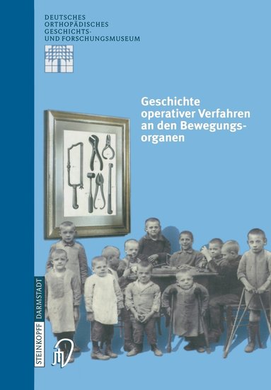 bokomslag Geschichte operativer Verfahren an den Bewegungsorganen