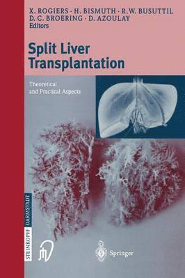 bokomslag Split liver transplantation