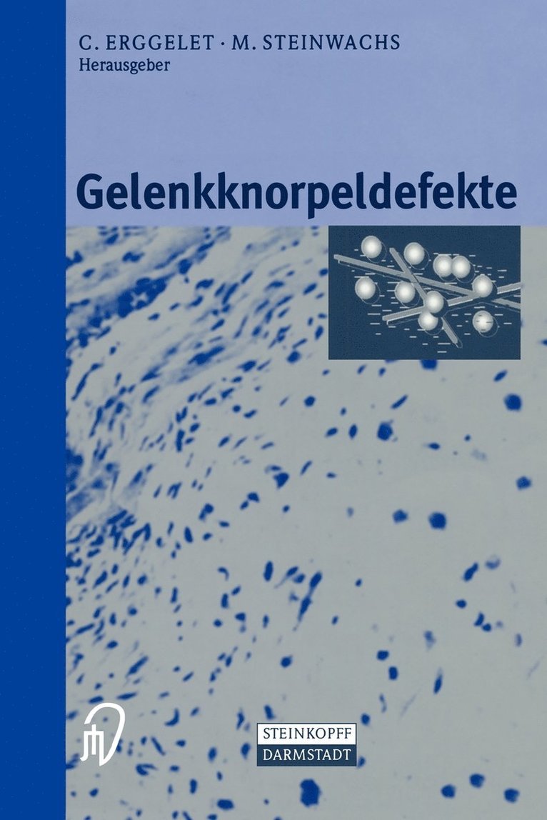 Gelenkknorpeldefekte 1