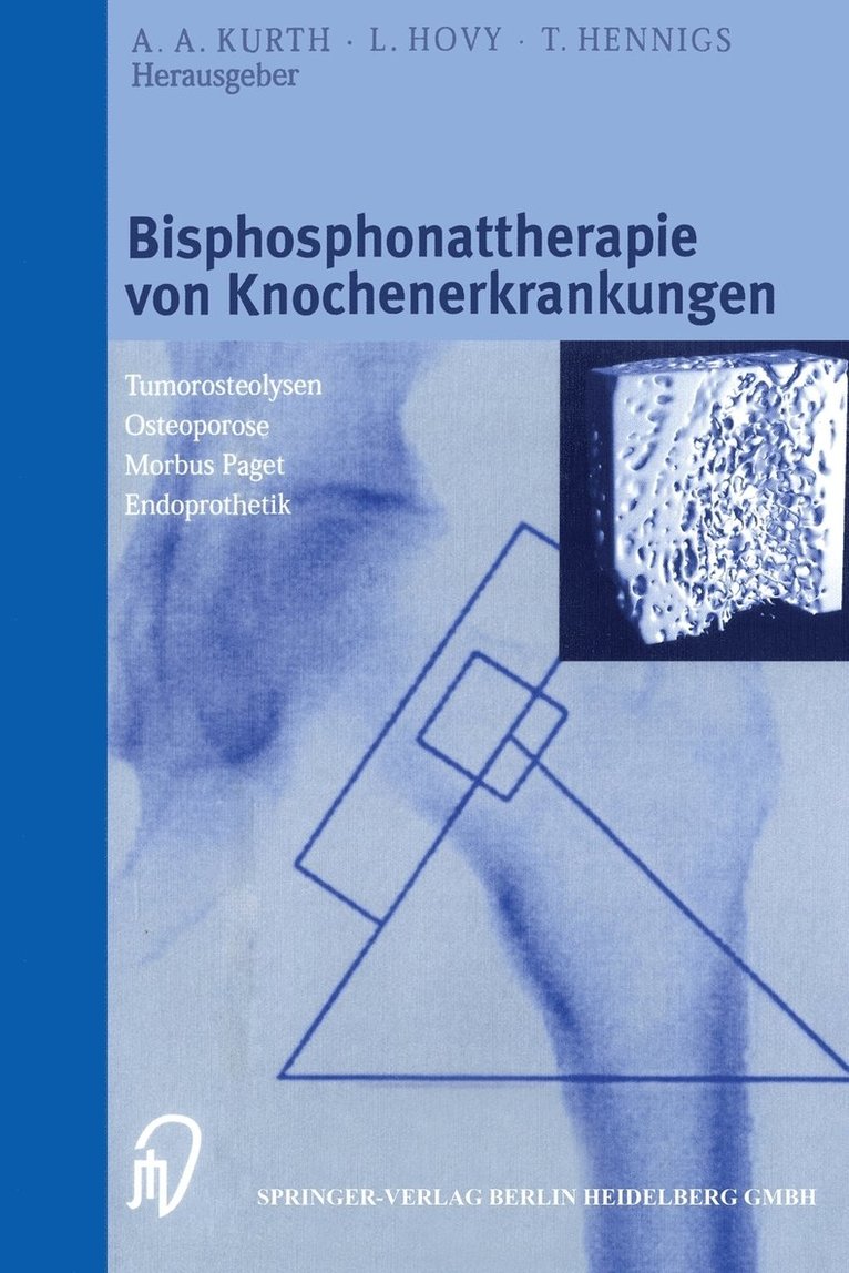 A.A. Kurth, L. Hovy, T. Hennigs, A. A. Kurth, Louis Hovy - Bisphosphonattherapie von Knochenerkrankungen, Häftad