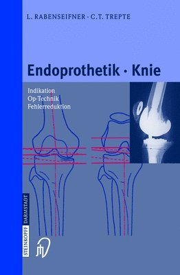 bokomslag Endoprothetik Knie