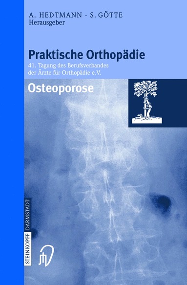 bokomslag Osteoporose