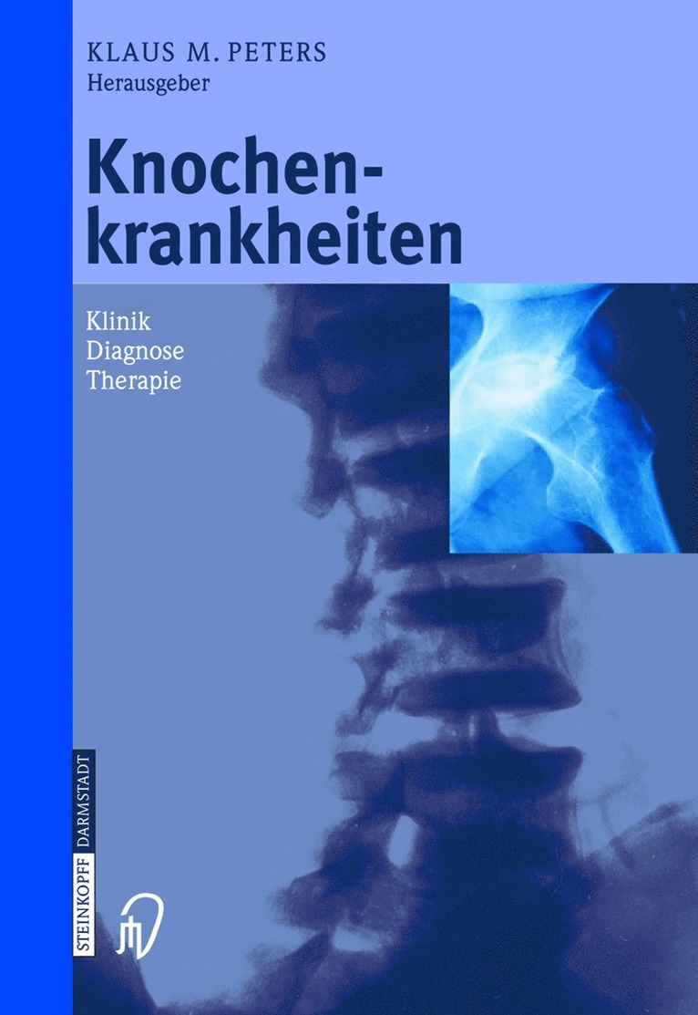 Knochenkrankheiten 1