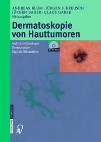 bokomslag Dermatoskopie Von Hauttumoren