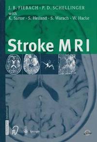 bokomslag Stroke MRI