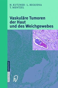 bokomslag Vaskulare Tumoren Der Haut Und Des Weichgewebes